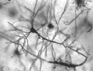 Complessità del neurone